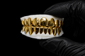 Gold Grillz